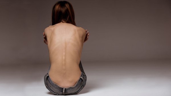 Lo que debes saber sobre la anorexia