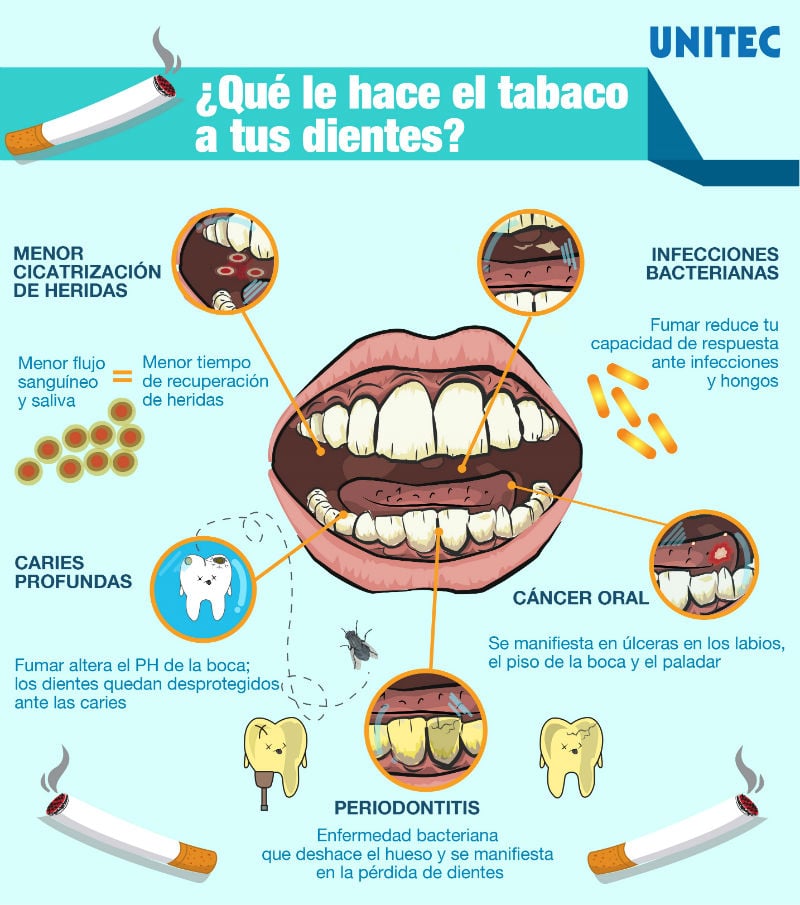 El tabaco y tus dientes: 5 efectos de fumar que desconocías