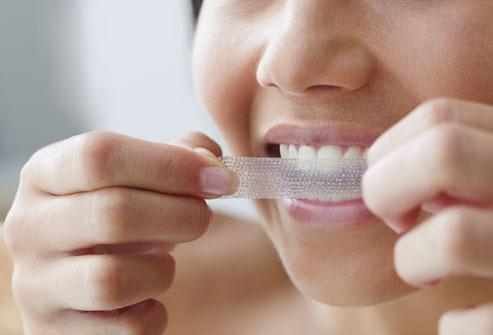 Lo que debes saber sobre el blanqueamiento dental