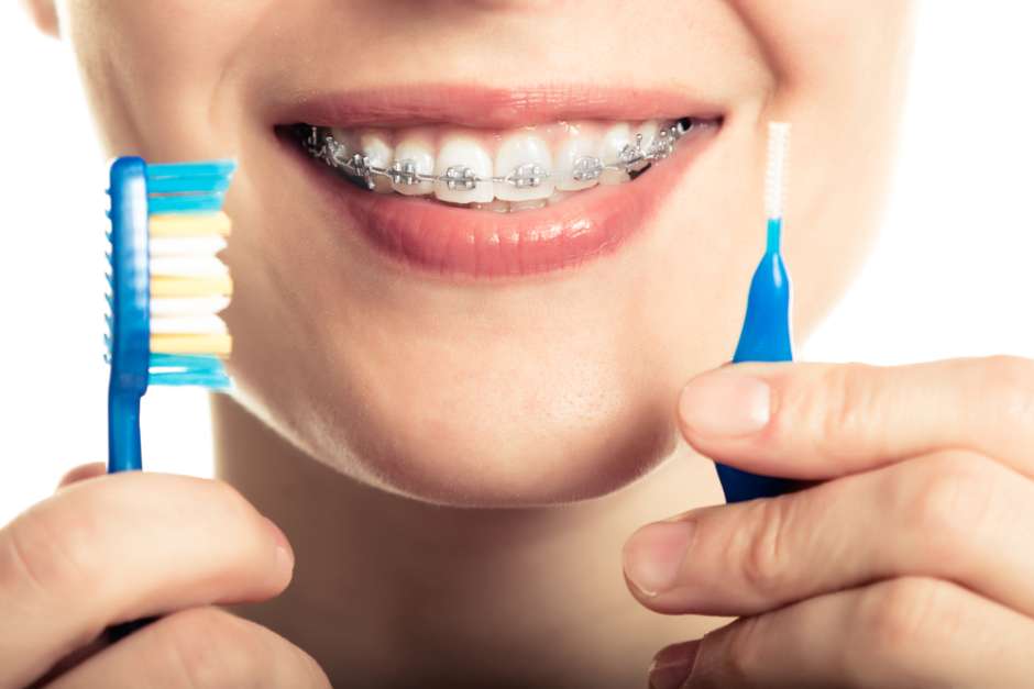 ¿Sabes por qué es importante ir al Dentista?